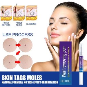 আচিল ও তিল রিমুভ ক্রিম Wart Remover Pen Gel Cream
